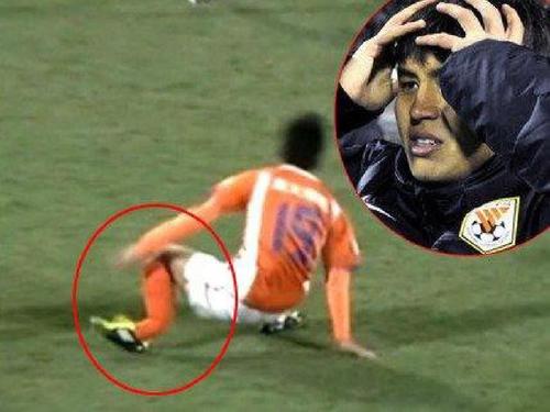 胫腓骨骨折需要关注什么,胫腓骨骨折有哪些类型