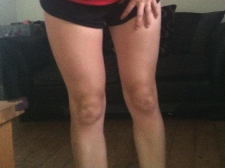 股内侧肌怎么拉伸放松,股外侧肌紧张怎么缓解