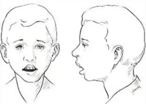 两岁还在用奶瓶,2岁宝宝还用奶瓶喝奶好不好
