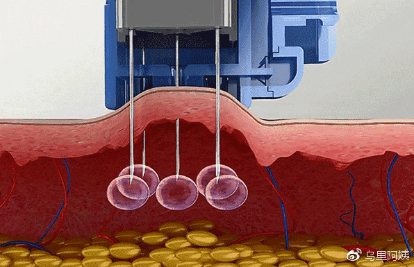 25岁脸部松弛下垂怎么紧致,25岁脸部松弛适合做什么项目