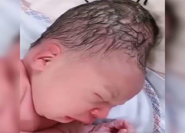 产妇用力不当胎儿头型会变吗,产妇用力不当导致胎儿头部畸形