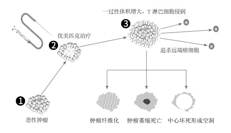 化学治疗和生物治疗,化学免疫治疗