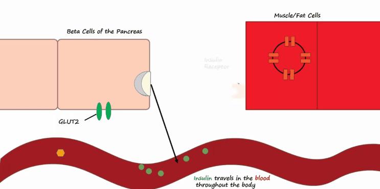 胰岛素是如何导致糖尿病的,胰岛素增多为什么会导致糖尿病