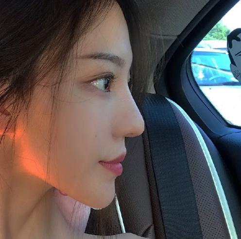 项思醒与整容医生聊天记录曝光，多次预约做手术，钱都让男友报销