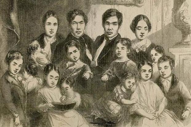 连体人是如何结婚生子呢,连体人结婚生了孩子是什么样子