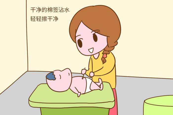 新生儿脐部护理相关视频,新生儿脐部红肿
