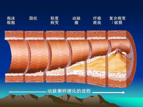 古代中医怎么治疗冠心病,大禹治水中的治应该怎么解释