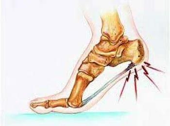 掌痛的最快解决办法,掌腕疼痛的治疗方法