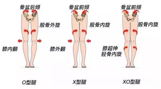 为什么腿控制不住的发抖,改善腿型有效不费劲简单方法