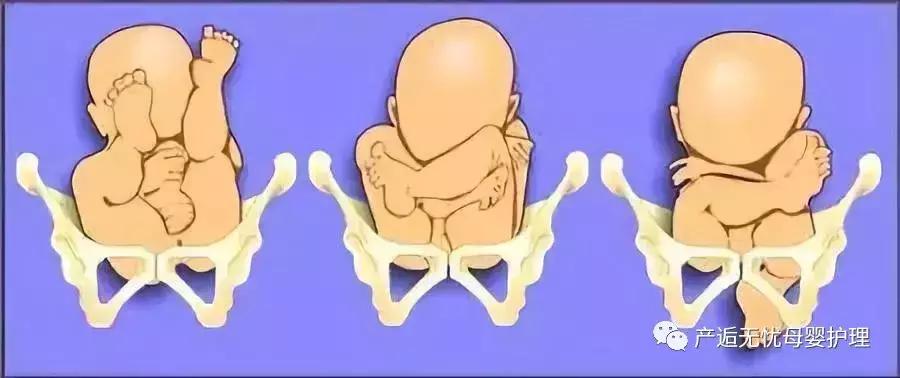 做盆骨的关注事项,怎么知道盆骨有没有达到要求