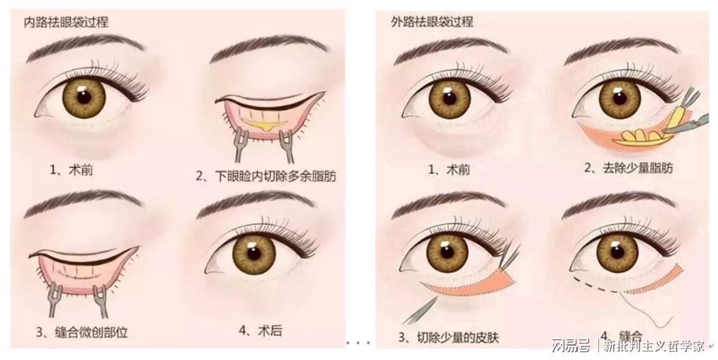 名医专访丨上海交通大学医学院附属同仁医院许瑾：面部美容整形