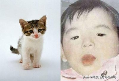 先天基因缺陷罕见病叫什么,基因出问题有治愈的可能吗