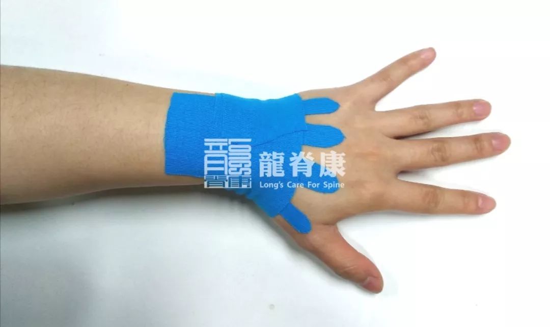 手腕扭伤的全面处理攻略，快收藏！