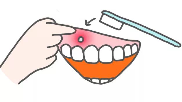 正畸疫情复诊,口腔科应对新冠疫情的控制措施