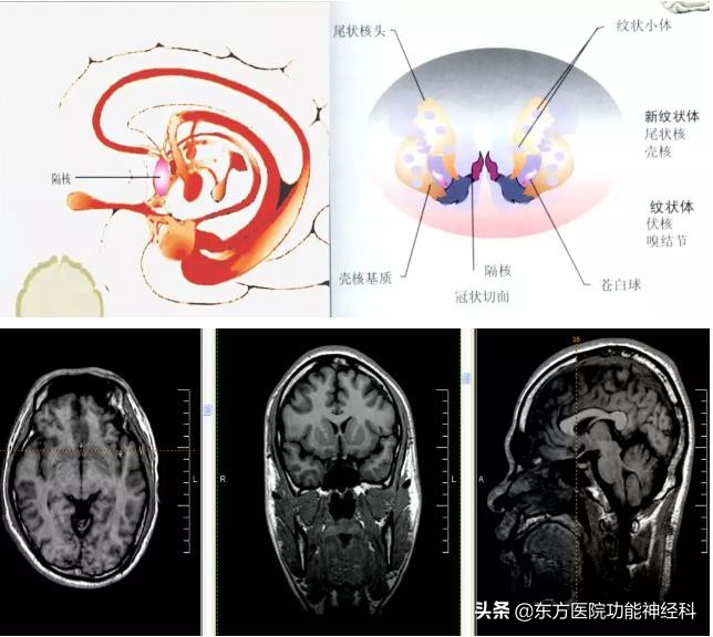 精神病人的前世,精神科药物的前世今生