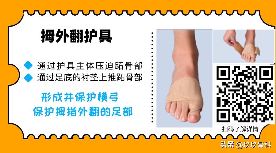 拇外翻的女人命真的苦吗,困扰女性的拇外翻