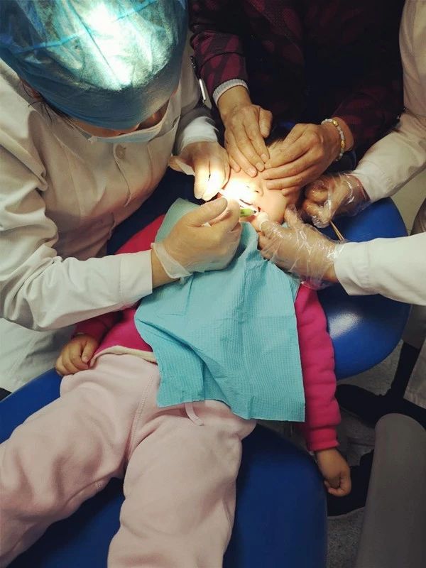 窝沟封闭适合几岁孩子做,在家给娃做窝沟封闭