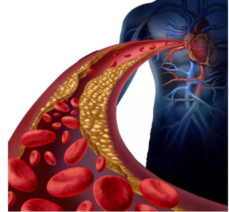 服用参松养心胶囊时期能吃萝卜吗,服用芪参益气滴丸