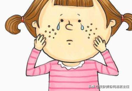 痘印顽固怎么消除医美,鼻子上顽固痘印可以用激光祛除吗