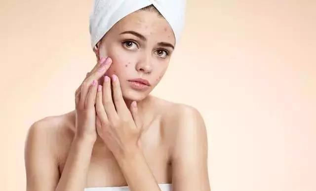 名门泽佳快速消除痘印,名门泽佳315防晒