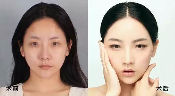 就因为这四个部位，别人像15而你像45