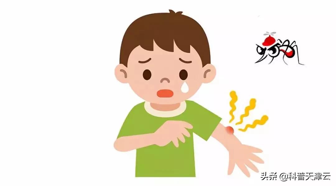 儿童被蚊子咬了怎么止痒消肿,宝宝蚊子包怎样快速消肿止痒