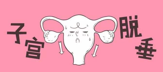 子宫脱垂做什么运动,子宫脱垂还能怀孕吗