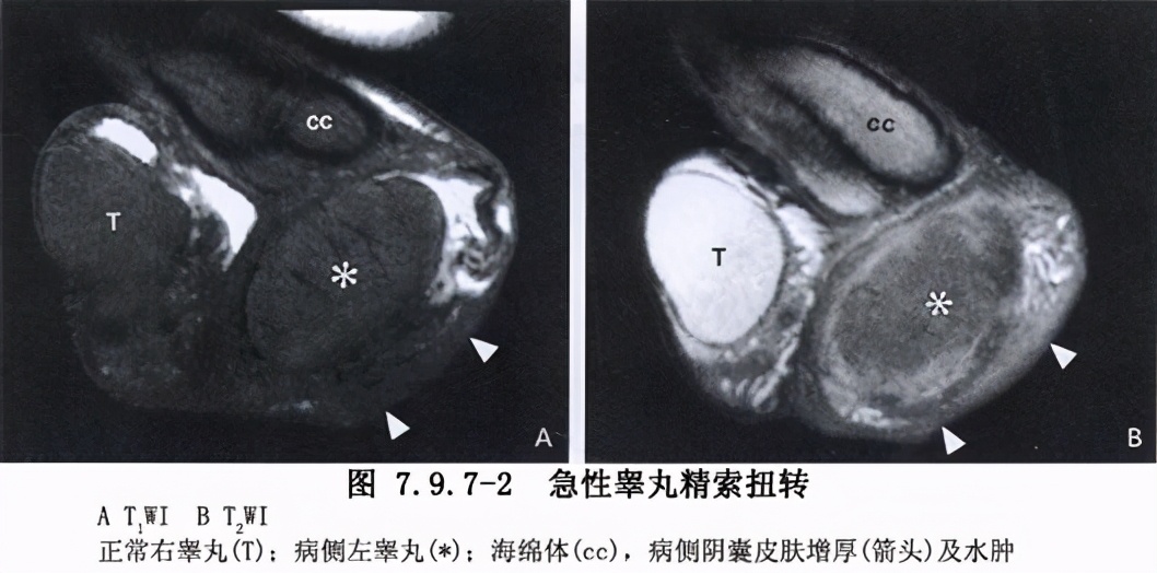 男性健康日应该准备什么,全国男性健康日