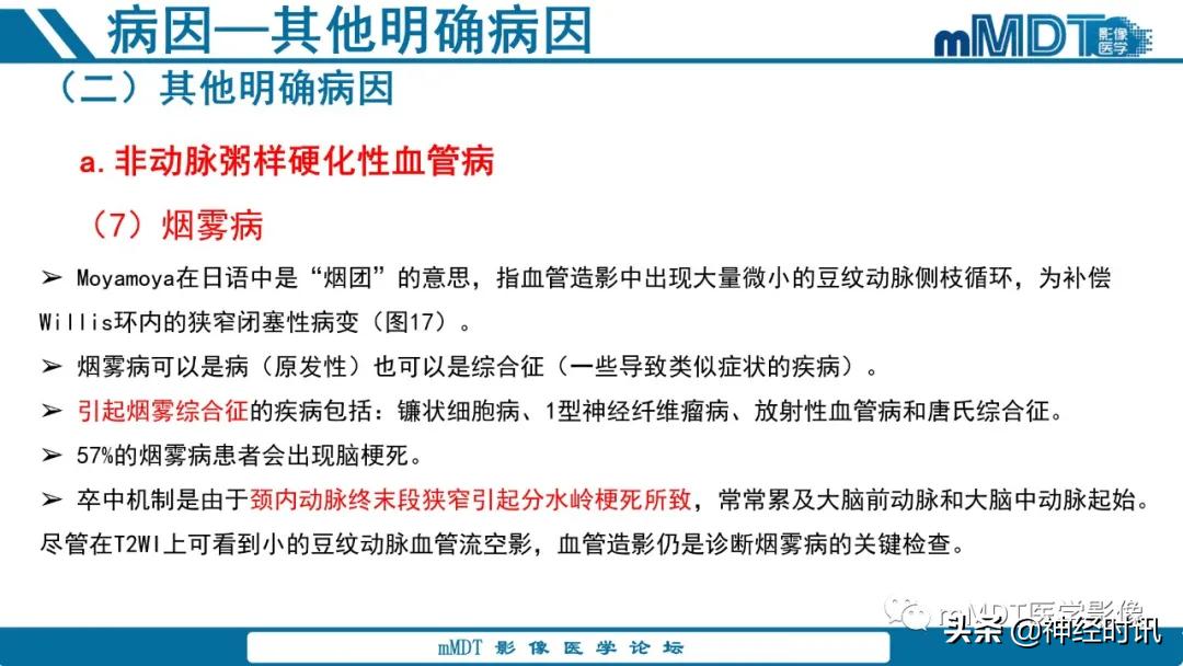 缺血性脑卒中护理课件,缺血性脑卒中讲课ppt