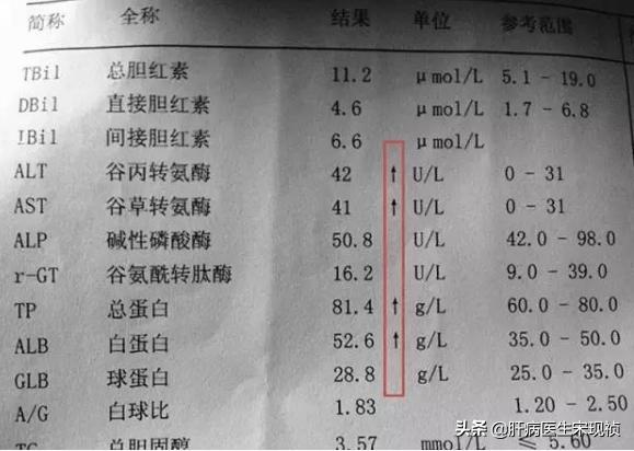 肝功白蛋白球蛋白偏高是什么意思,肝功能中的球蛋白偏高是什么意思