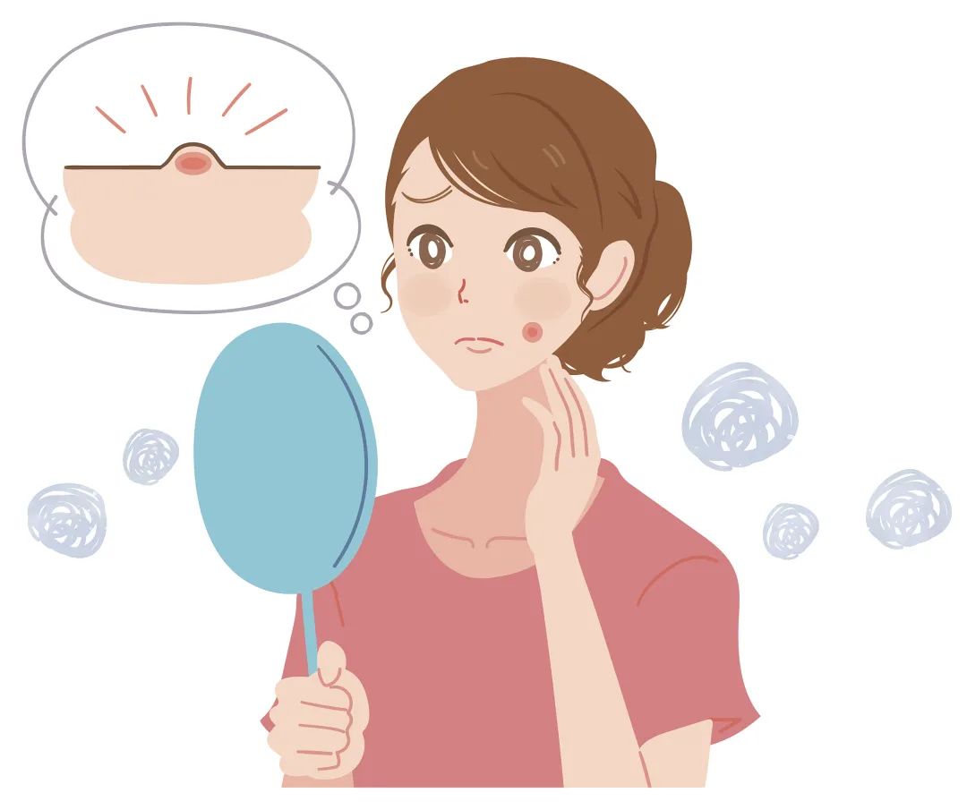 为什么会长痘应该怎么祛痘,教你一招搞定痘痘告别烦人痘印