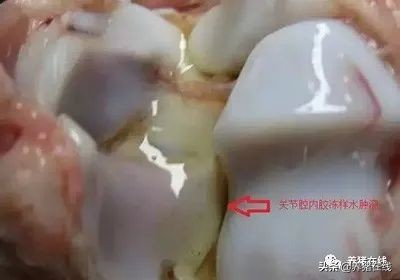 头孢和什么搭配最好,头孢可以搭配什么药