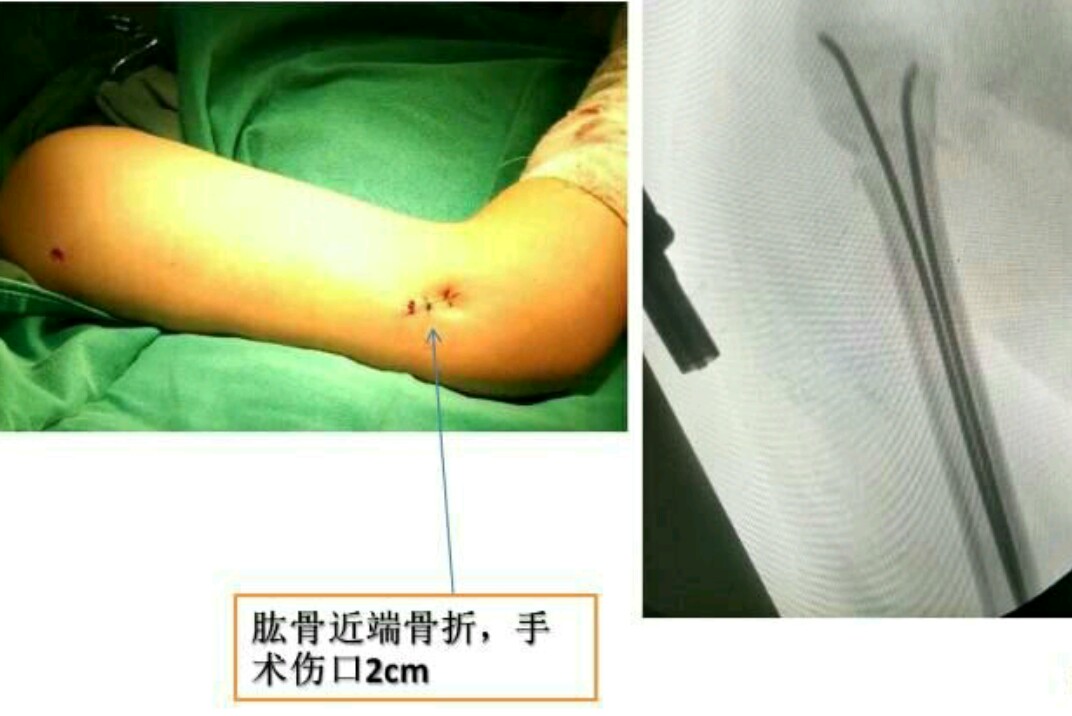 邱医生手术,邱医生祛疤