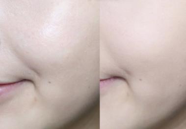 夏季毛孔清爽一夏,夏日毛孔粗大怎么拯救