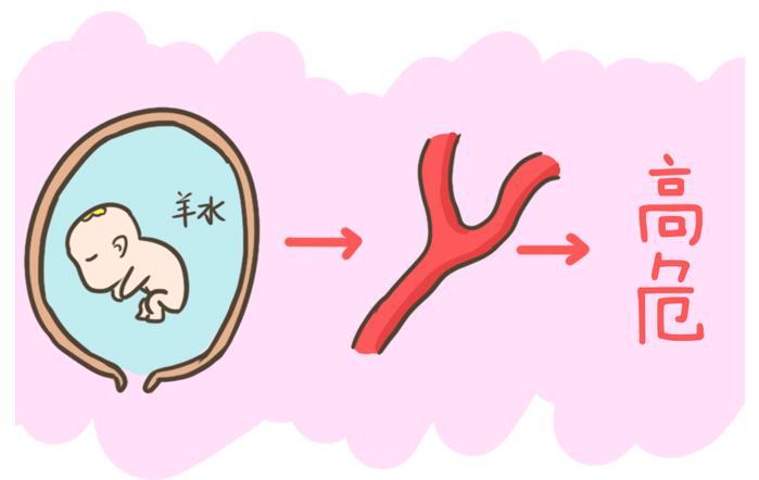 产科的风险,产科危险疾病