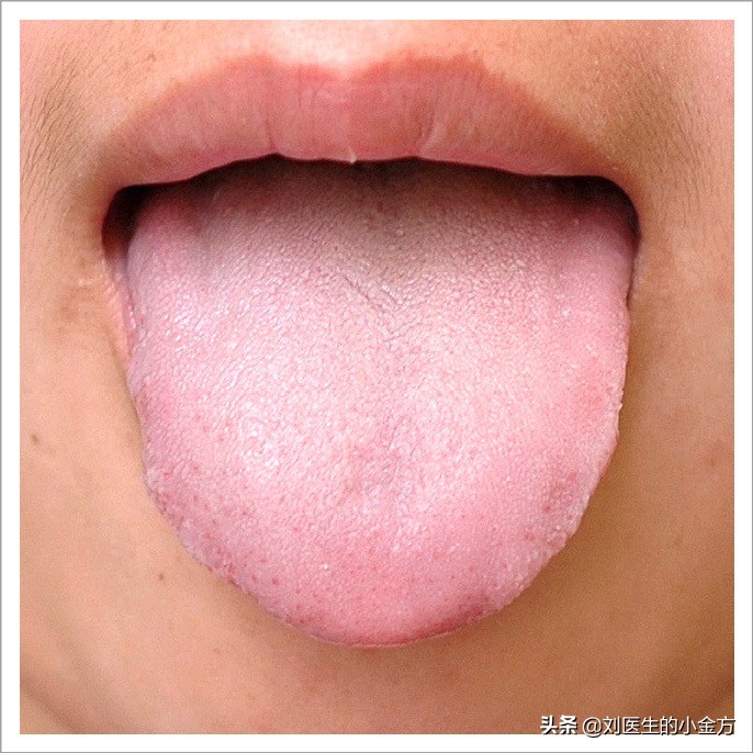 中医舌诊图解100例,中医舌诊图与舌诊口诀