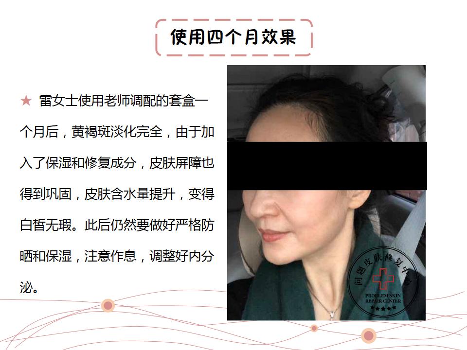 激光反黑怎么快速修复,点阵激光反黑了怎么修复