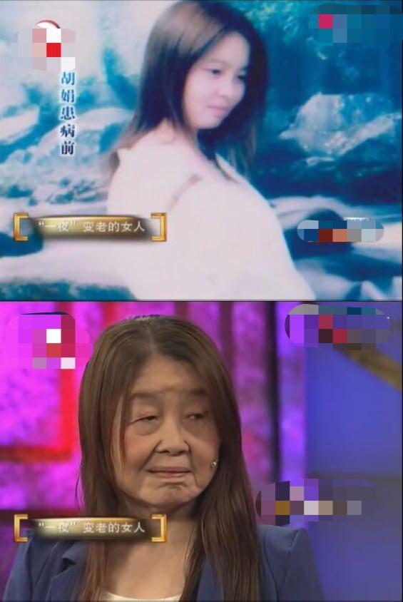 20岁少女一夜变成老太婆,妙龄少女一夜间变成老太太后续