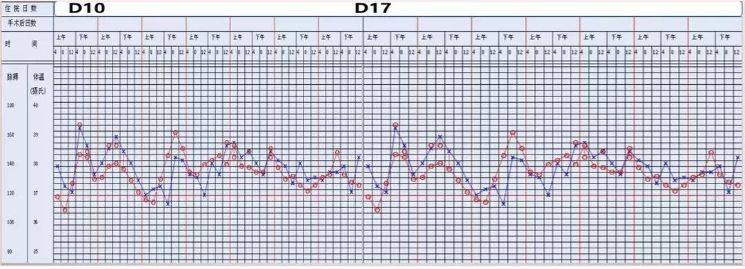 万古霉素用于mrsa的作用机制,万古霉素无效还有什么抗生素可用