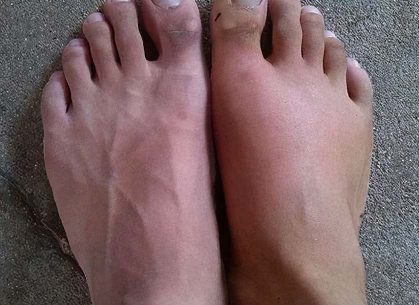 吃盐很少对身体有什么影响,吃太多盐怎么化解