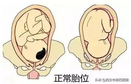 剖宫产的孩子和顺产的孩子的区别,一胎剖宫产二胎顺产的几率有多大