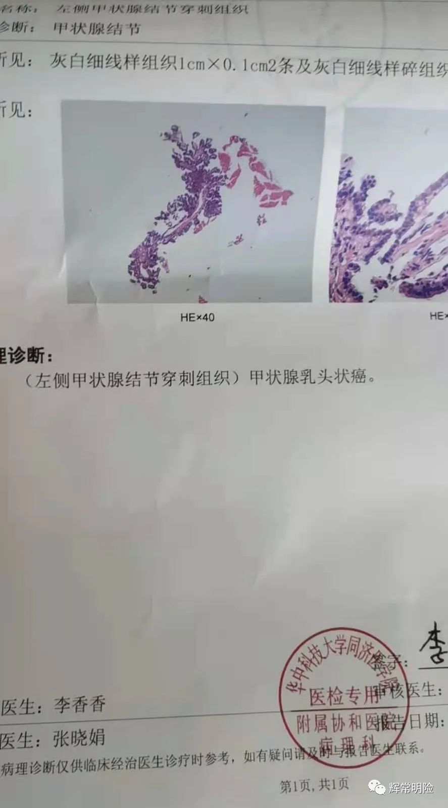 理赔实录|甲状腺癌赔50.91万，免除保险费25.5万，保障继续有效