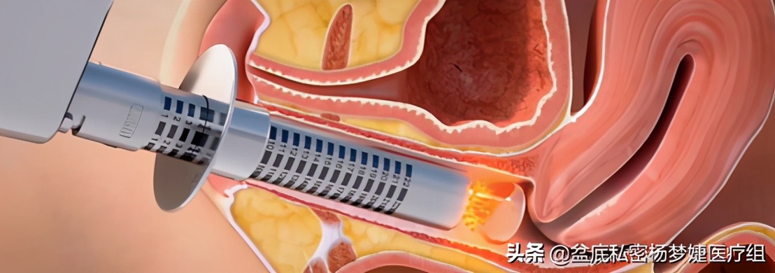 女性之声余红梅,女性之声原创