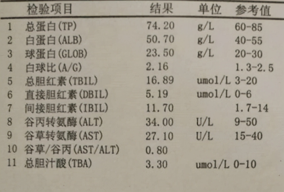 体检报告看不懂31种指标,体检报告看不懂