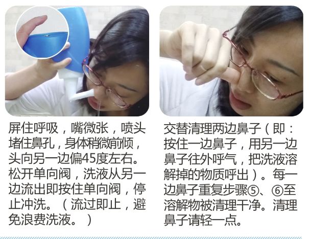 洗鼻真的对鼻炎有用吗,鼻腔有必要洗鼻吗