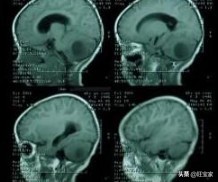 男人也有孕反应腰酸吗,男人也怀孩子