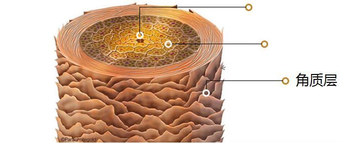 孕妇头发干枯毛躁怎么护理,老人头发干枯毛躁怎么护理