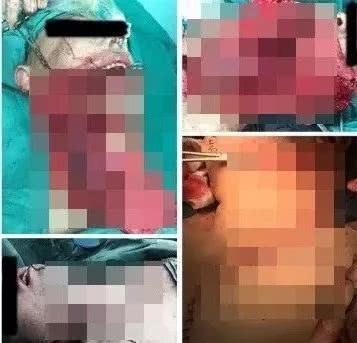 鎻湶妲熸涓庡彛鑵旂檶 (鍏充簬妲熸涓庡彛鑵旂檶鐨勫叧绯讳笌浣滅敤)