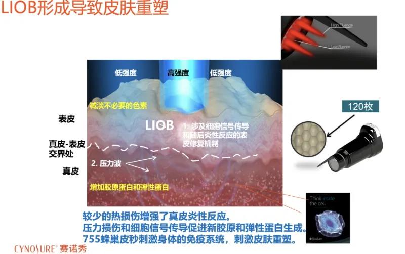 做完蜂巢皮秒饮食关注,做完蜂巢皮秒后起泡了怎么护理