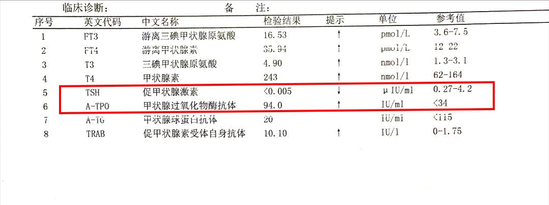 甲亢感觉眼睛有一点点突算严重吗,甲亢从刚突眼到严重需要多长时间